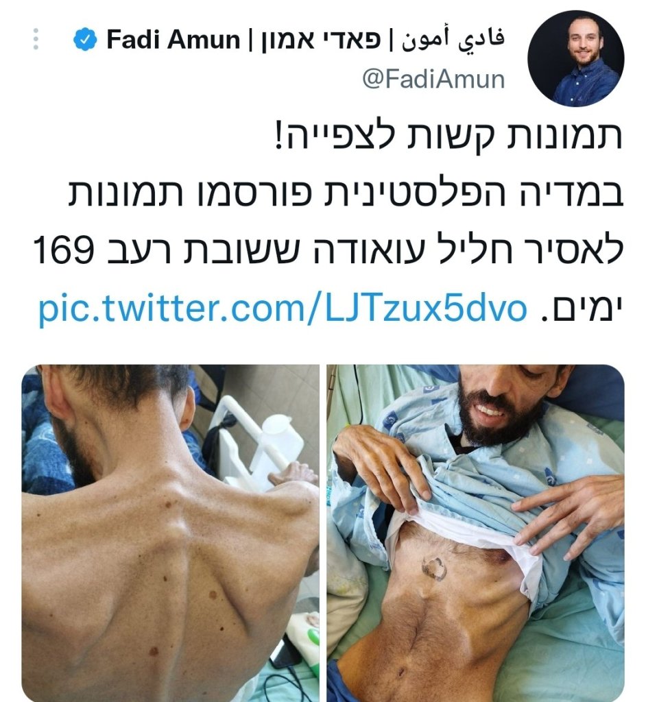 חליל עוואודה ביום 169 של שביתת רעב